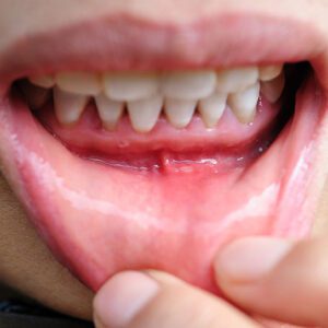 Sandi E. Silva, DDS -